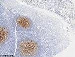 CD21 Antibody in Immunohistochemistry (Paraffin) (IHC (P))