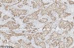 MSH2 Antibody in Immunohistochemistry (Paraffin) (IHC (P))