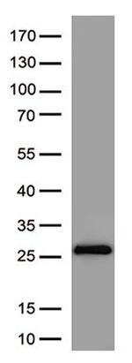 SARS-CoV-2 Spike Protein Antibody in Western Blot (WB)