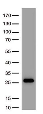 SARS-CoV-2 Spike Protein Antibody in Western Blot (WB)