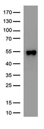 SARS-CoV-2 N Protein Antibody in Western Blot (WB)