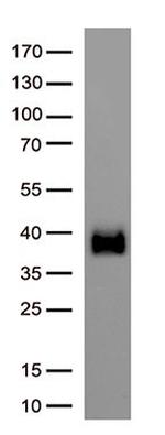 SARS-CoV-2 Spike Protein Antibody in Western Blot (WB)