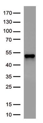SARS-CoV-2 N Protein Antibody in Western Blot (WB)