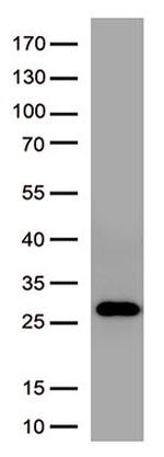 SARS-CoV-2 Spike Protein Antibody in Western Blot (WB)