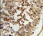 TC2N Antibody in Immunohistochemistry (IHC)