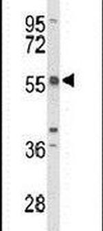 TC2N Antibody in Western Blot (WB)