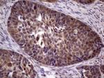 TACC1 Antibody in Immunohistochemistry (Paraffin) (IHC (P))