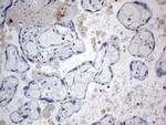 TACC2 Antibody in Immunohistochemistry (Paraffin) (IHC (P))