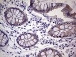 TACC2 Antibody in Immunohistochemistry (Paraffin) (IHC (P))