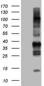 TACC2 Antibody in Western Blot (WB)