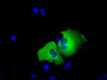 TACC3 Antibody in Immunocytochemistry (ICC/IF)