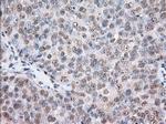TACC3 Antibody in Immunohistochemistry (Paraffin) (IHC (P))