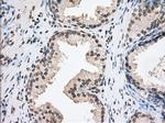 TACC3 Antibody in Immunohistochemistry (Paraffin) (IHC (P))
