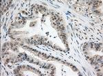 TACC3 Antibody in Immunohistochemistry (Paraffin) (IHC (P))