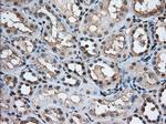 TACC3 Antibody in Immunohistochemistry (Paraffin) (IHC (P))