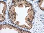 TACC3 Antibody in Immunohistochemistry (Paraffin) (IHC (P))