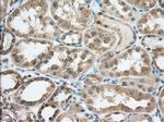 TACC3 Antibody in Immunohistochemistry (Paraffin) (IHC (P))