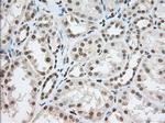 TACC3 Antibody in Immunohistochemistry (Paraffin) (IHC (P))