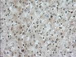 TACC3 Antibody in Immunohistochemistry (Paraffin) (IHC (P))