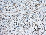 TACC3 Antibody in Immunohistochemistry (Paraffin) (IHC (P))