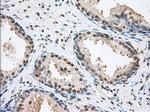 TACC3 Antibody in Immunohistochemistry (Paraffin) (IHC (P))