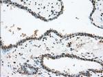 TACC3 Antibody in Immunohistochemistry (Paraffin) (IHC (P))