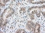 TACC3 Antibody in Immunohistochemistry (Paraffin) (IHC (P))