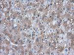 TACC3 Antibody in Immunohistochemistry (Paraffin) (IHC (P))