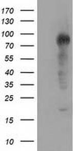 TACC3 Antibody in Western Blot (WB)
