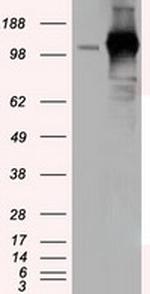 TACC3 Antibody in Western Blot (WB)