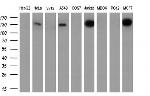 TACC3 Antibody in Western Blot (WB)
