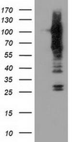 TACC3 Antibody in Western Blot (WB)