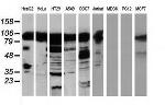 TACC3 Antibody in Western Blot (WB)