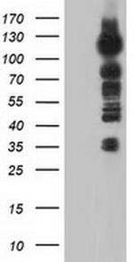 TACC3 Antibody in Western Blot (WB)
