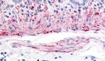 TACR2 Antibody in Immunohistochemistry (Paraffin) (IHC (P))