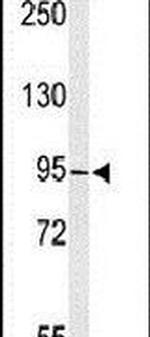 TAF3 Antibody in Western Blot (WB)