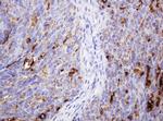 TAG-72/CA 72-4 Antibody in Immunohistochemistry (Paraffin) (IHC (P))