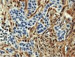 TAGLN Antibody in Immunohistochemistry (Paraffin) (IHC (P))
