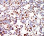 TAK1 Antibody in Immunohistochemistry (IHC)