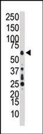 TAK1 Antibody in Western Blot (WB)