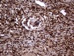 TALDO1 Antibody in Immunohistochemistry (Paraffin) (IHC (P))