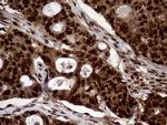 TALDO1 Antibody in Immunohistochemistry (Paraffin) (IHC (P))