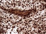 TALDO1 Antibody in Immunohistochemistry (Paraffin) (IHC (P))