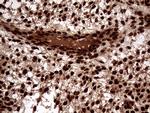 TALDO1 Antibody in Immunohistochemistry (Paraffin) (IHC (P))