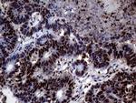 TALDO1 Antibody in Immunohistochemistry (Paraffin) (IHC (P))