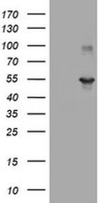 TAPBPL Antibody in Western Blot (WB)