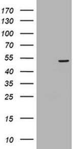 TAPBPL Antibody in Western Blot (WB)