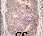 TASP1 Antibody in Immunohistochemistry (IHC)