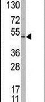 TASP1 Antibody in Western Blot (WB)