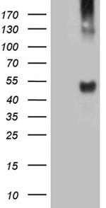 TAT Antibody in Western Blot (WB)